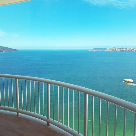 Hotel Amares Acapulco Ngoại thất bức ảnh